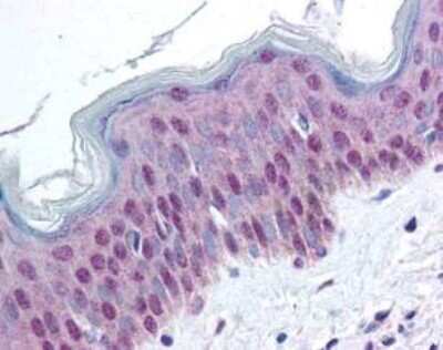 Immunohistochemistry: HMGN1/HMG14 [p Ser20, p Ser24] Antibody [NBP1-78102]